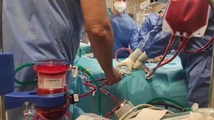 El equipo ECMO de La Arrixaca salva a un bebé con cardiopatía